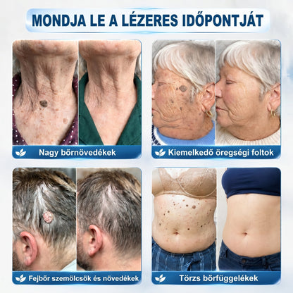𝑯𝒊𝒗𝒂𝒕𝒂𝒍𝒐𝒔 𝒎á𝒓𝒌𝒂𝒃𝒐𝒍𝒕✅ | 𝑷𝒊𝒄𝒅𝒐® 7 𝒏𝒂𝒑𝒐𝒔 𝒃ő𝒓𝒌𝒊𝒏ö𝒗é𝒔- é𝒔 𝒇𝒐𝒍𝒕𝒆𝒍𝒕á𝒗𝒐𝒍í𝒕ó 𝒕𝒐𝒍𝒍 👩‍⚕️(𝒇á𝒋𝒅𝒂𝒍𝒐𝒎𝒎𝒆𝒏𝒕𝒆𝒔, 𝒉𝒆𝒈 𝒏é𝒍𝒌ü𝒍𝒊, 𝒑𝒓𝒆𝒄í𝒛𝒊ó𝒔 𝒈𝒐𝒍𝒚ó𝒔 𝒂𝒑𝒑𝒍𝒊𝒌á𝒕𝒐𝒓) 🌿