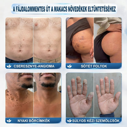 𝑯𝒊𝒗𝒂𝒕𝒂𝒍𝒐𝒔 𝒎á𝒓𝒌𝒂𝒃𝒐𝒍𝒕✅ | 𝑷𝒊𝒄𝒅𝒐® 7 𝒏𝒂𝒑𝒐𝒔 𝒃ő𝒓𝒌𝒊𝒏ö𝒗é𝒔- é𝒔 𝒇𝒐𝒍𝒕𝒆𝒍𝒕á𝒗𝒐𝒍í𝒕ó 𝒕𝒐𝒍𝒍 👩‍⚕️(𝒇á𝒋𝒅𝒂𝒍𝒐𝒎𝒎𝒆𝒏𝒕𝒆𝒔, 𝒉𝒆𝒈 𝒏é𝒍𝒌ü𝒍𝒊, 𝒑𝒓𝒆𝒄í𝒛𝒊ó𝒔 𝒈𝒐𝒍𝒚ó𝒔 𝒂𝒑𝒑𝒍𝒊𝒌á𝒕𝒐𝒓) 🌿