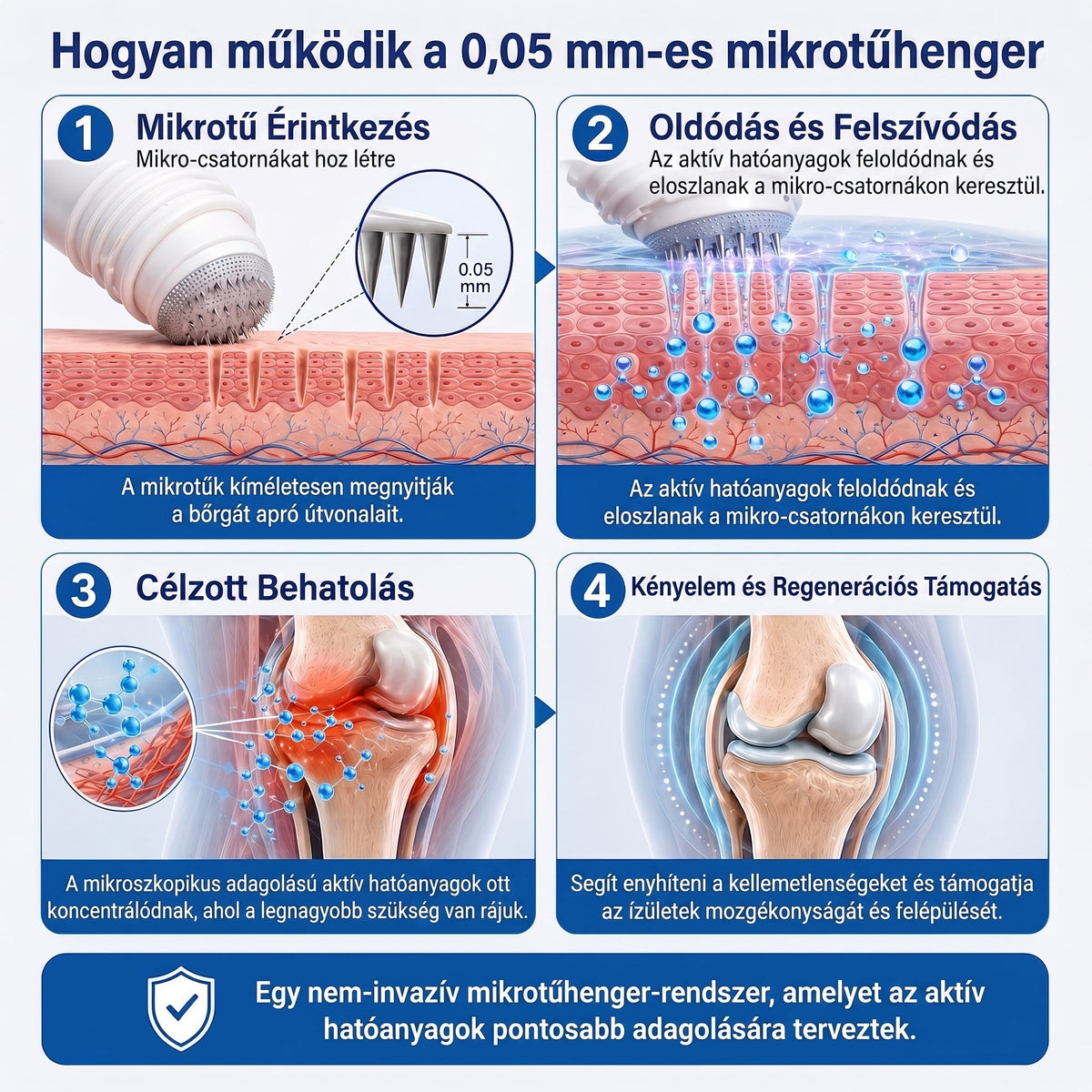 𝐎𝐫𝐯𝐨𝐬𝐢 𝐬𝐳𝐚𝐤𝐞́𝐫𝐭𝐨̋𝐤 𝐚́𝐥𝐭𝐚𝐥 𝐤𝐢𝐟𝐞𝐣𝐥𝐞𝐬𝐳𝐭𝐯𝐞👨‍⚕️| 𝑿𝑹𝑳𝑿𝑹𝑳® 0,05 mm-es mikrotűs csont- és ízületregeneráló roll-on
